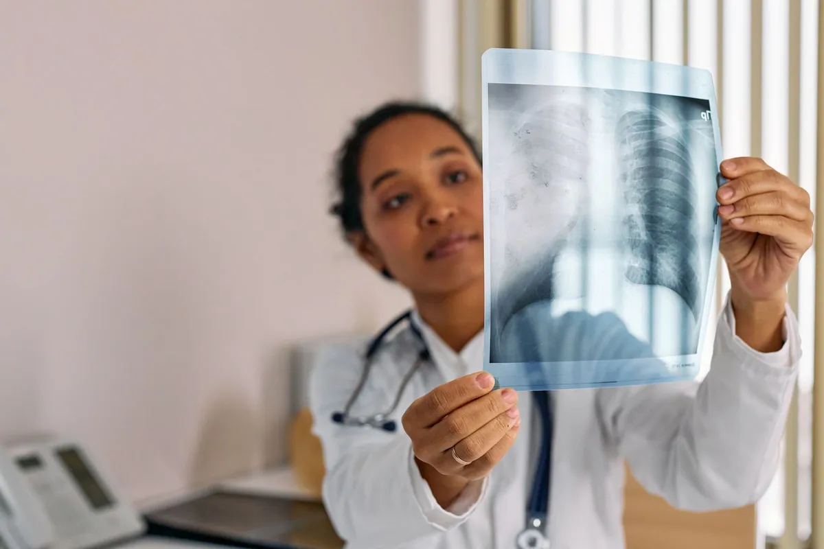 Clinician holding up a chest x-ray showing the lungs and ribcage, illustrating what lung damage looks like on a scan